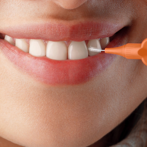 Ершики межзубные Revyline Smart, размер 1 (0,45 мм) оранжевые, 6 шт.